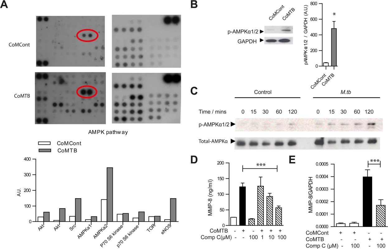 AMPK regulates neutrophil MMP-8 secretion in TB <i>in vitro</i>.