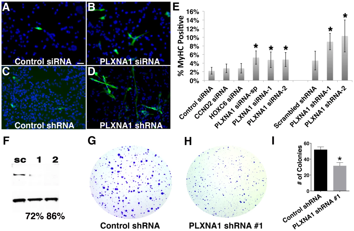 Knockdown of PLXNA1 induced differentiation and impaired anchorage-independent growth of human ERMS cells.
