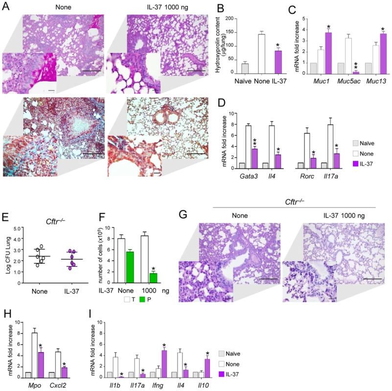 IL-37 restrains inflammation in fungal allergy and <i>Cftr<sup>−/−</sup></i> mice.