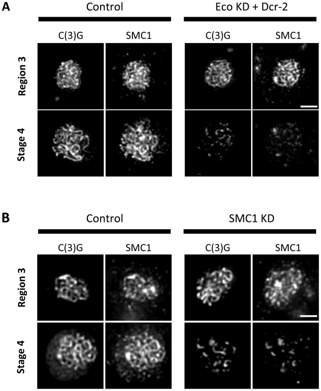 Maintenance of chromosome cores during pachytene requires Eco activity and synthesis of SMC1.