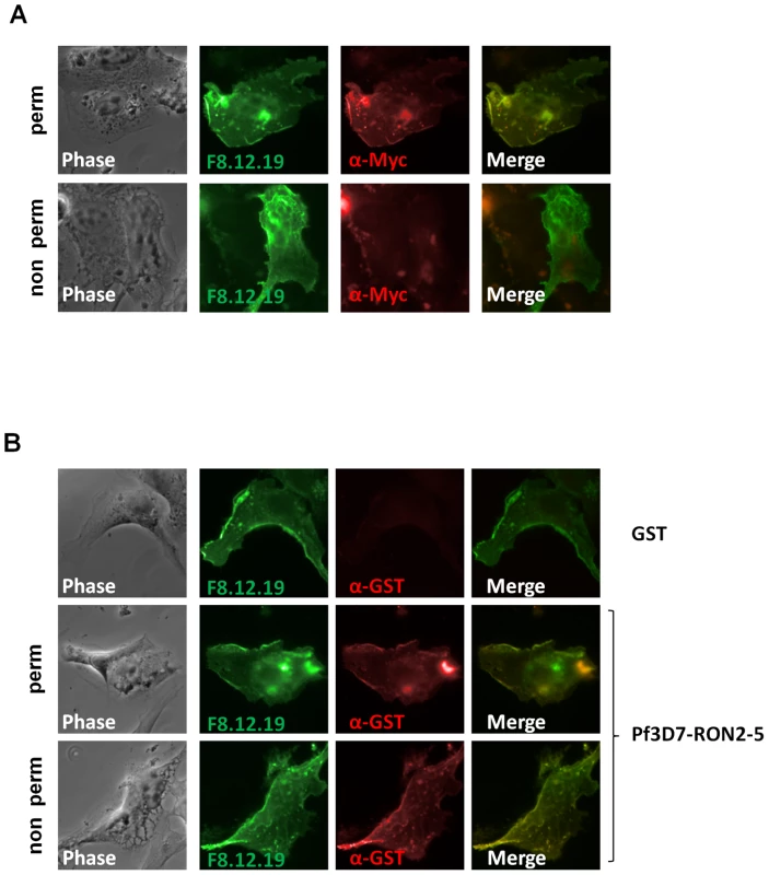 RON2-AMA1 interaction is conserved in <i>P. falciparum</i>.