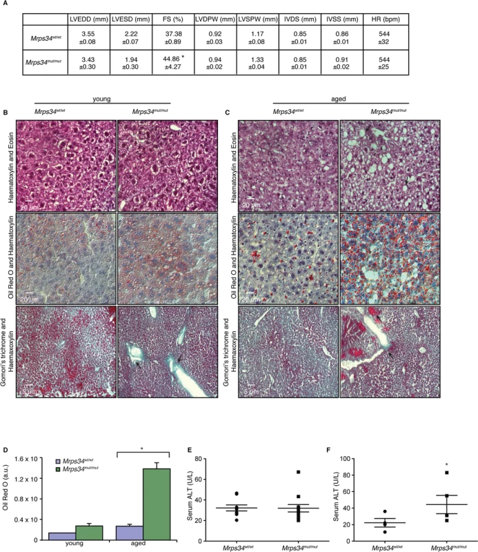<i>Mrps34</i><sup><i>mut/mut</i></sup> mice have hypertrophic hearts and increased lipid accumulation in their livers.