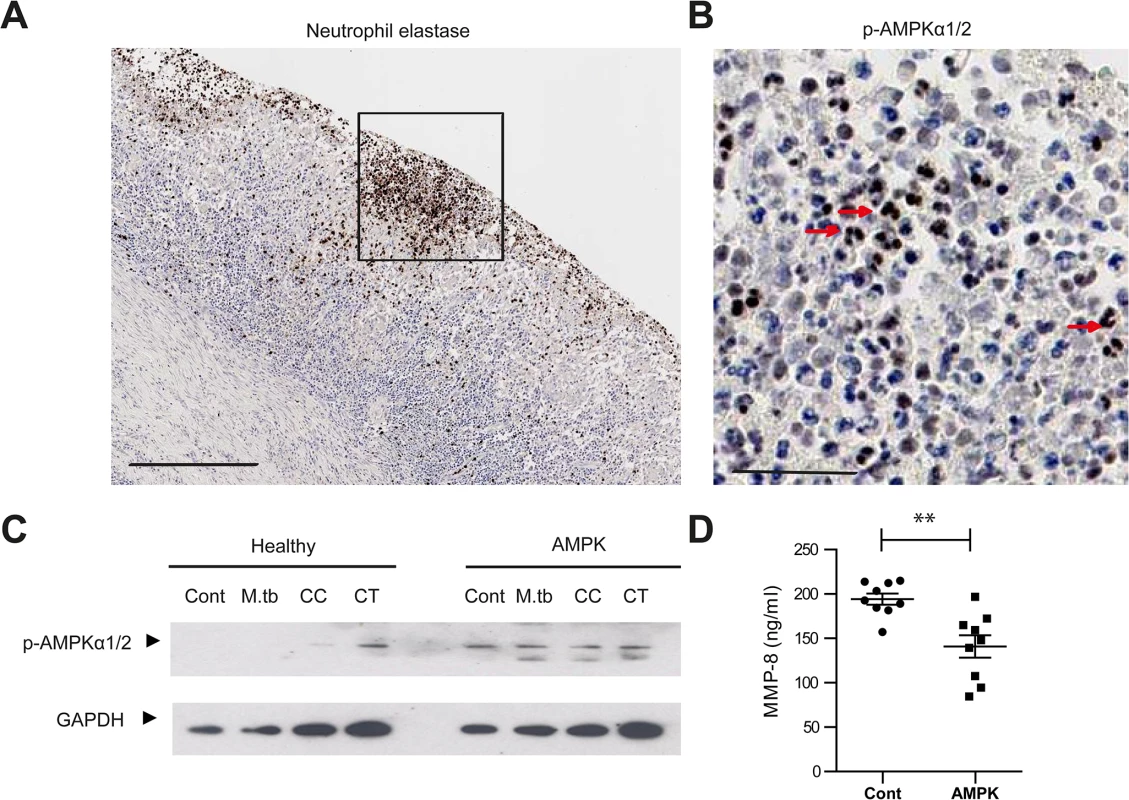 AMPK regulates neutrophil MMP-8 secretion in patients.