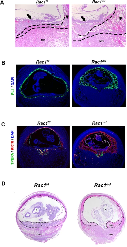 Abnormal trophoblast proliferation, differentiation and disorganized placentation in <i>Rac1</i> conditional-knockout mouse.