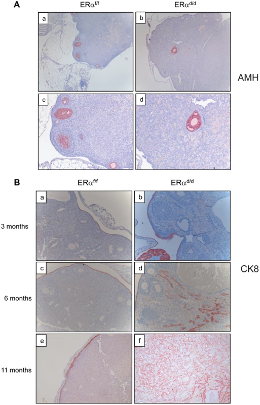 Development of ovarian tumors in ERα<sup>d/d</sup> mice.