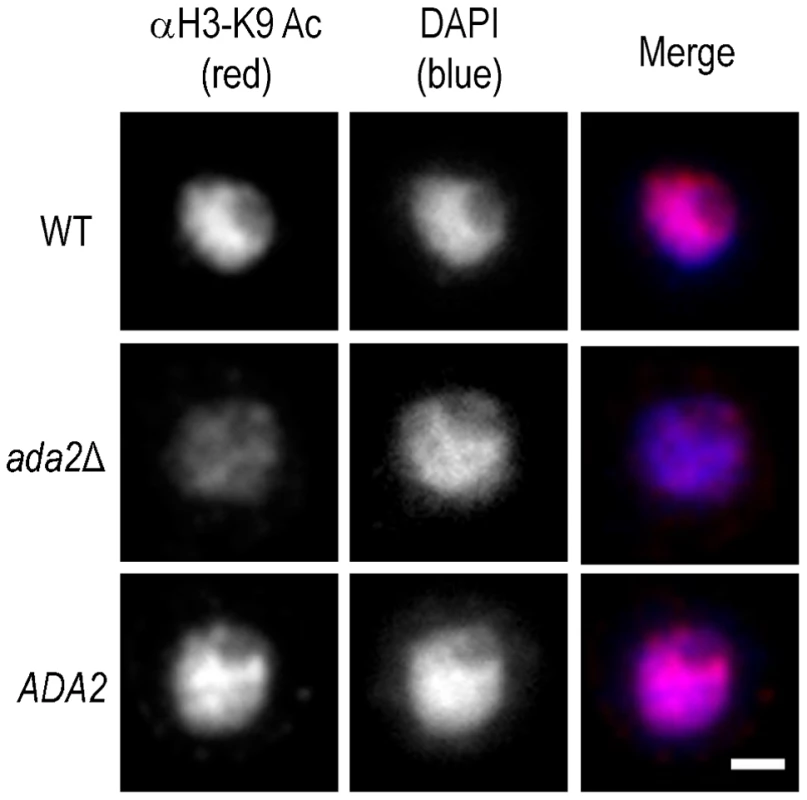 Histone acetylation is markedly reduced in the absence of Ada2.