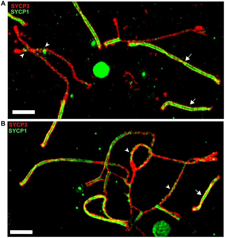 Super-resolution microscopy of synaptonemal complexes on spreads of (B6.PWD-Chr X.1s×PWD) pachytene spermatocytes.