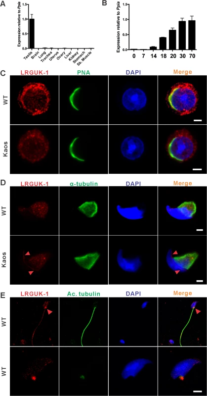 LRGUK-1 is highly expressed in the testis and the localizes to the acrosome-acroplaxoneme-manchette-tail network.