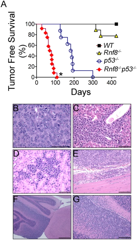 Cooperation of Rnf8 and p53 in the prevention of tumorigenesis.