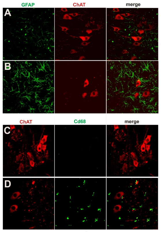 Activation of glial cells in paralyzed mutant <i>TDP</i> transgenic rats.