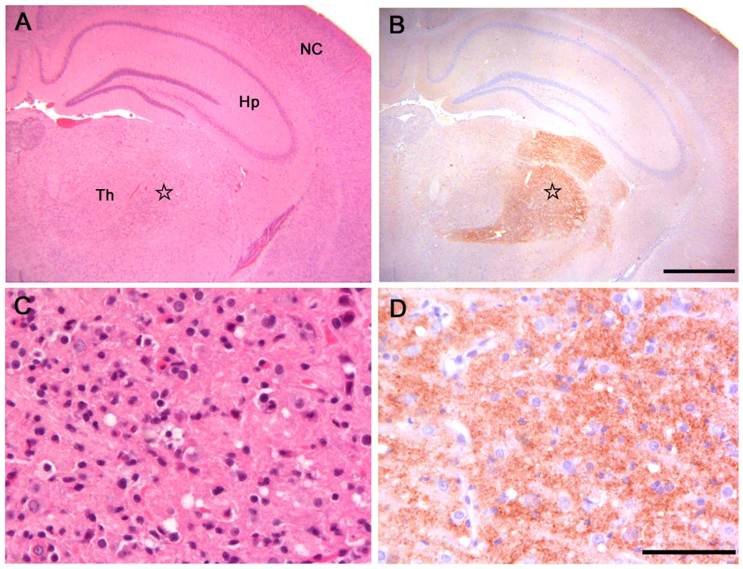 Histopathological and immunohistochemical analysis of Bv109I inoculated with Bv<sup>109I</sup>CWD.