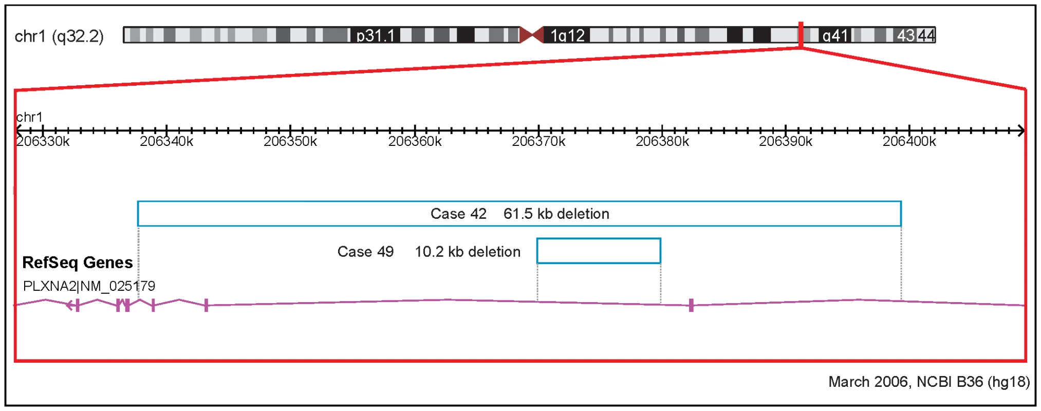 Rare CNVs overlapping novel candidate gene for tetralogy of Fallot: PLXNA2.