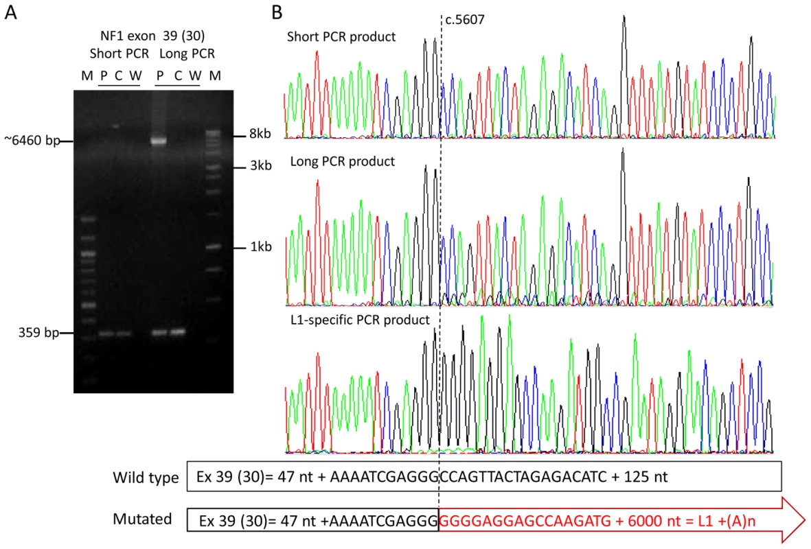 Amplification of the mutant allele containing a full-length L1 element inserted into exon 39 (30).