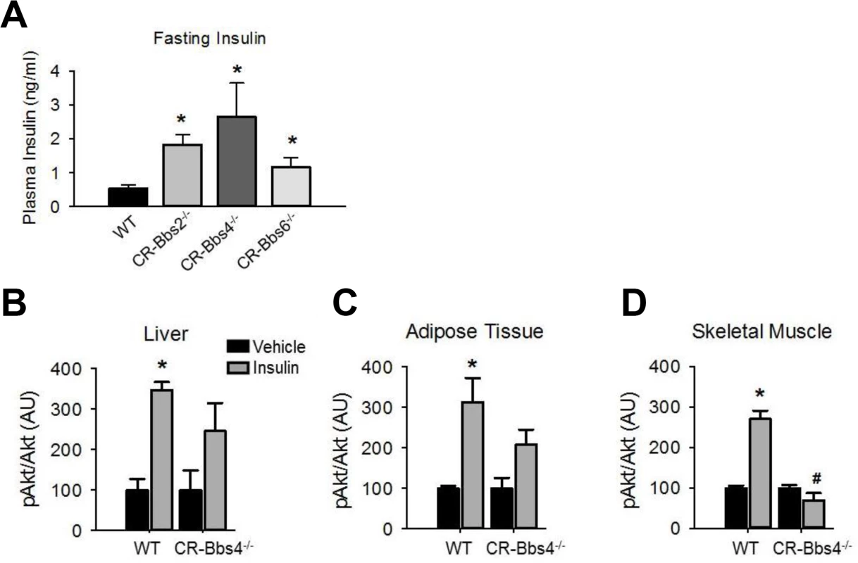Alterations in insulin action and signaling in BBS mice is not related to obesity.