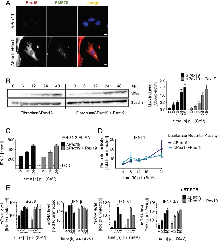 Activation of type I and III IFN response in peroxisome-deficient human cells.