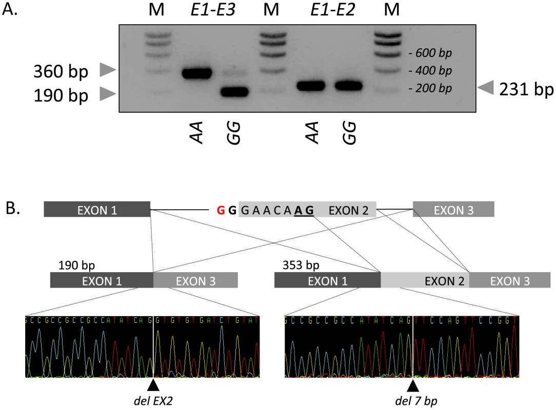 Effect of the c124-2A&gt;G splice site variant on <i>RNF11</i> transcripts.
