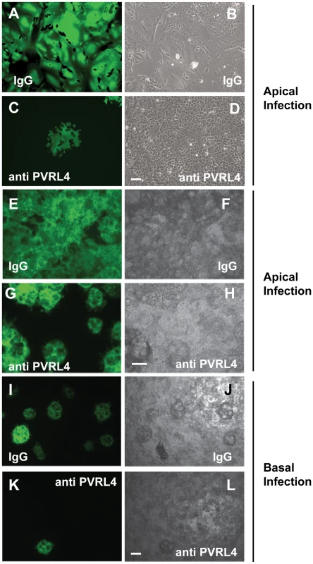 Antibodies specific for human PVRL4 inhibit wtMV infection in MCF7 cells.