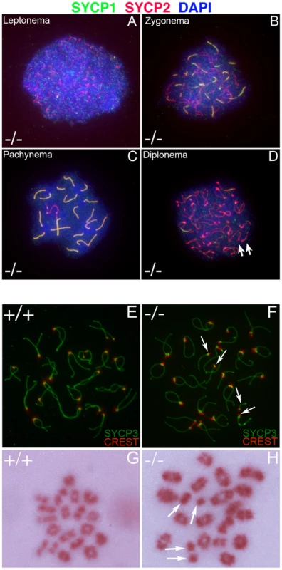 Formation of univalent chromosomes in <i>Chtf18</i><sup>−/−</sup> spermatocytes.