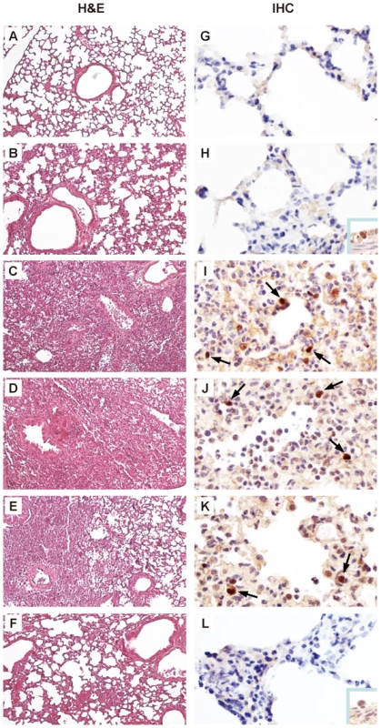Histopathology and immunohistochemistry in lung tissues of mice infected with rEG/D1 viruses.