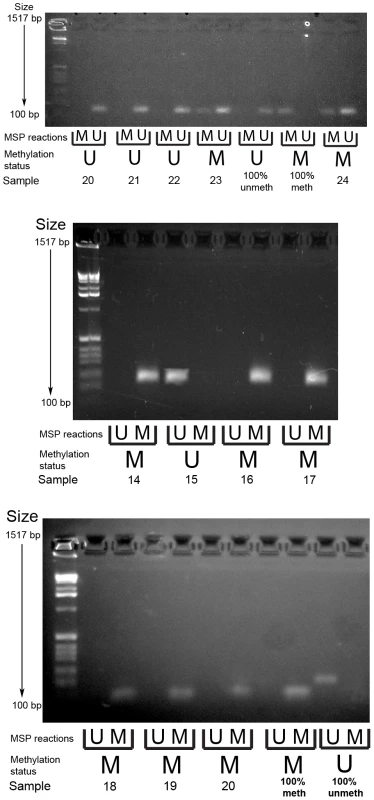 Example gel image of PCDH7 promoter methylation-specific PCR (top gel) and SLIT2 methylation-specific PCR (bottom and middle gels).