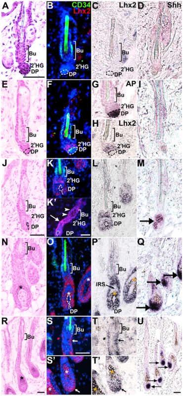 Lhx2 expression is associated with anagen during postnatal HF cycling and is not transcribed by CD34<sup>+</sup> bulge cells.