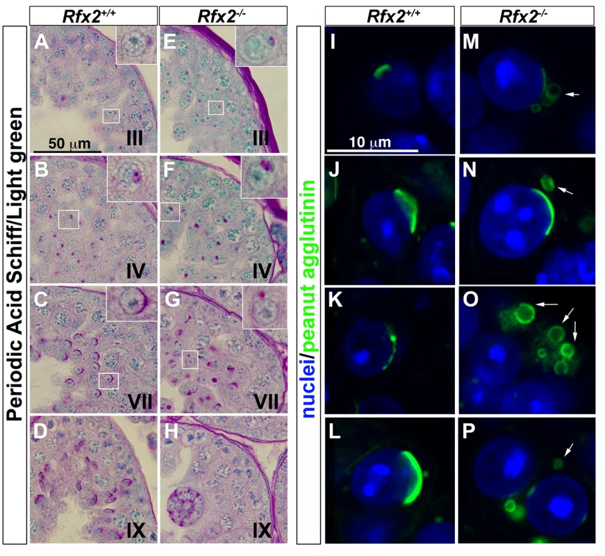 The characteristic acrosome organelle fails to develop properly in <i>Rfx2</i><sup>-/-</sup> mice.