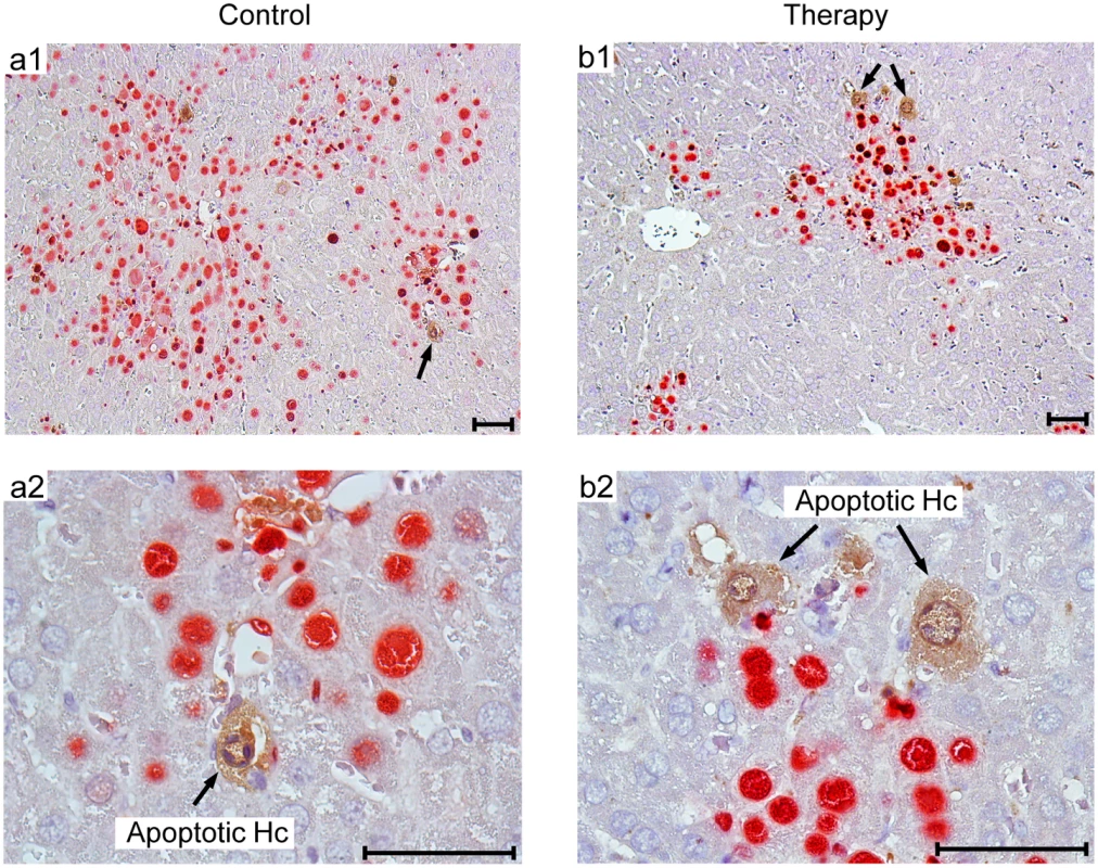 Human NLV-specific T cells do not exert an immunopathology in terms of enhanced apoptosis or necrotic/necroptotic lesions outside of foci of infection.
