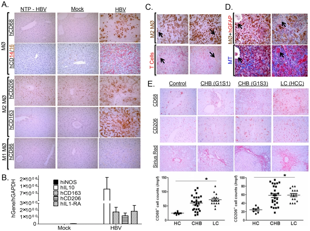 HBV-induced liver disease and immune impairment is associated with M2-like macrophage activation.