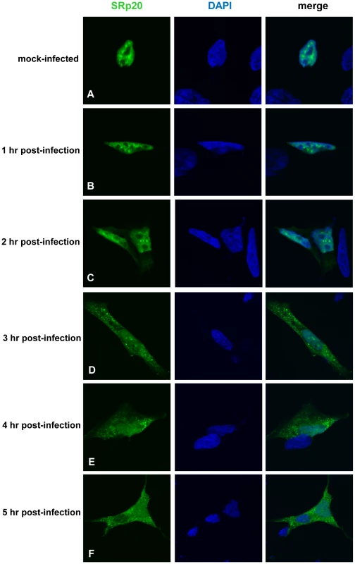 SRp20 re-localization from the nucleus to the cytoplasm of SK-N-SH cells during poliovirus infection.