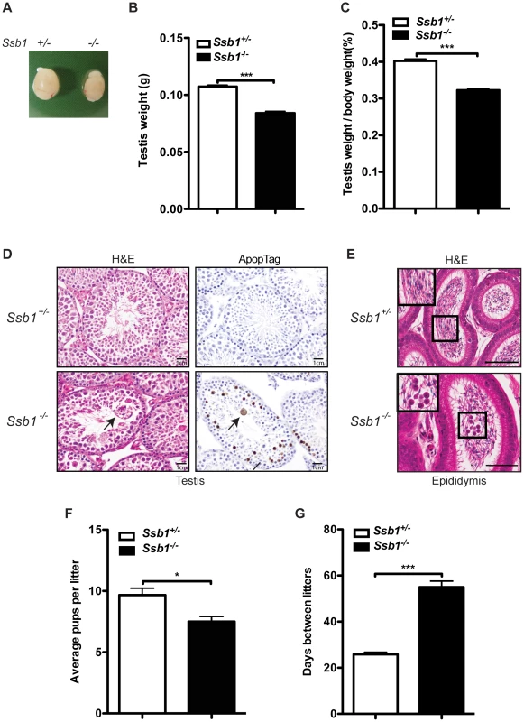 Testicular degeneration and impaired fertility in conditional <i>Rosa26</i>-CreER<sup>T2</sup>: <i>Ssb1</i><sup>−/−</sup> male mice.