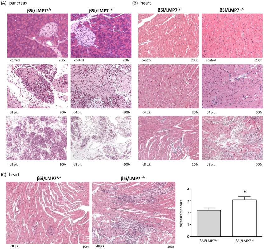 Severe acute CVB3-myocarditis in IP-deficient mice.