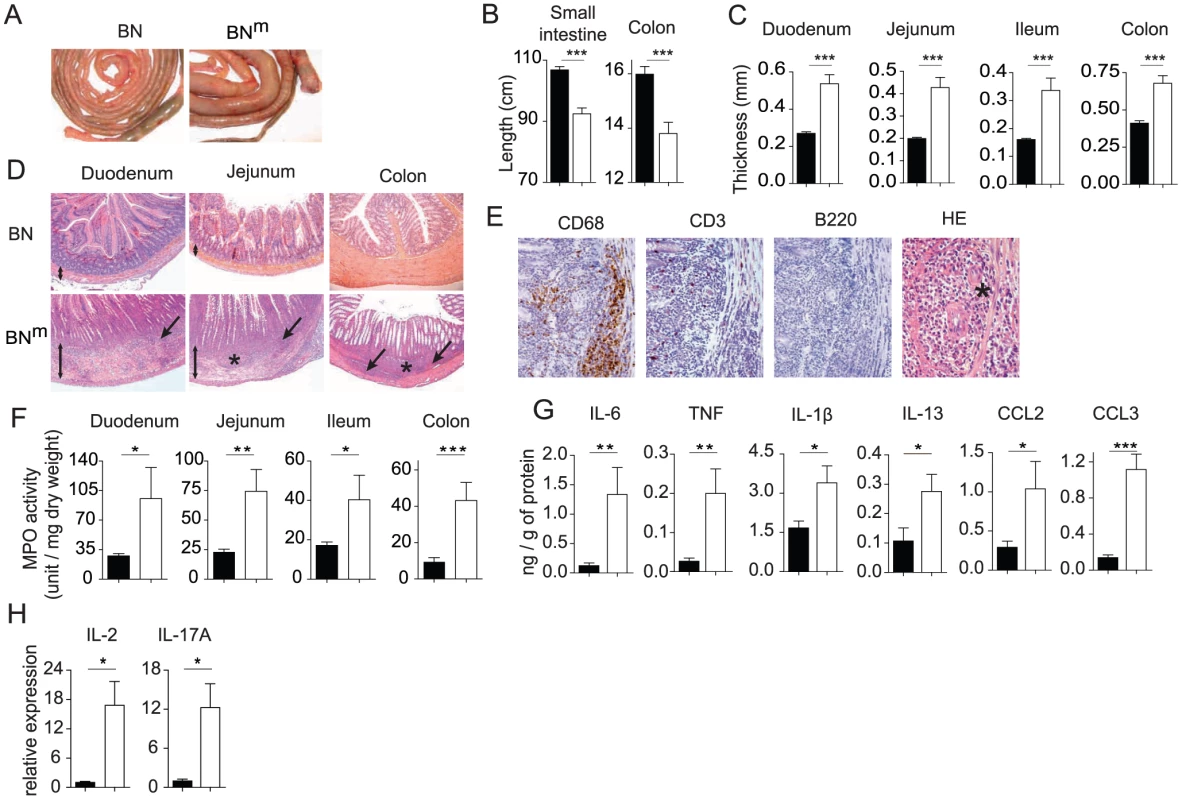BN<sup>m</sup> rats develop inflammatory bowel disease.