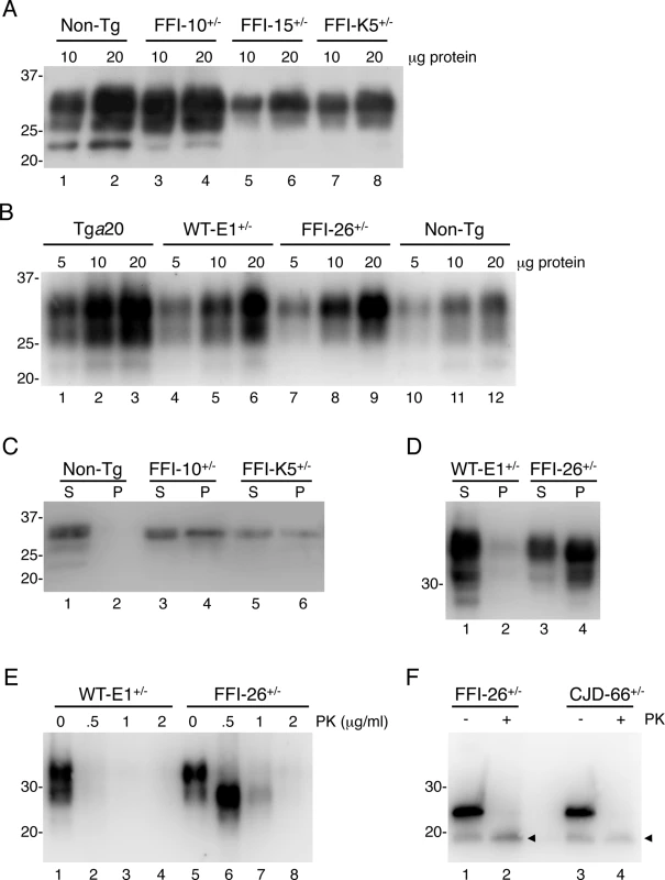 Mutant PrP in the brains of Tg(FFI) mice is insoluble and mildly protease-resistant.