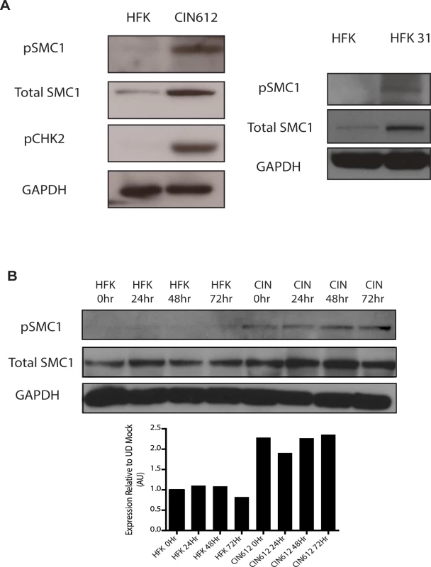 Levels of total SMC1 and pSMC1 are increased in HPV positive cells and remain high upon calcium-induced differentiation.