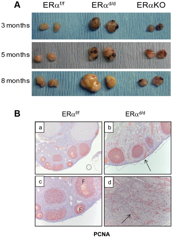 The ERα<sup>d/d</sup> mice form proliferative ovarian tumors.
