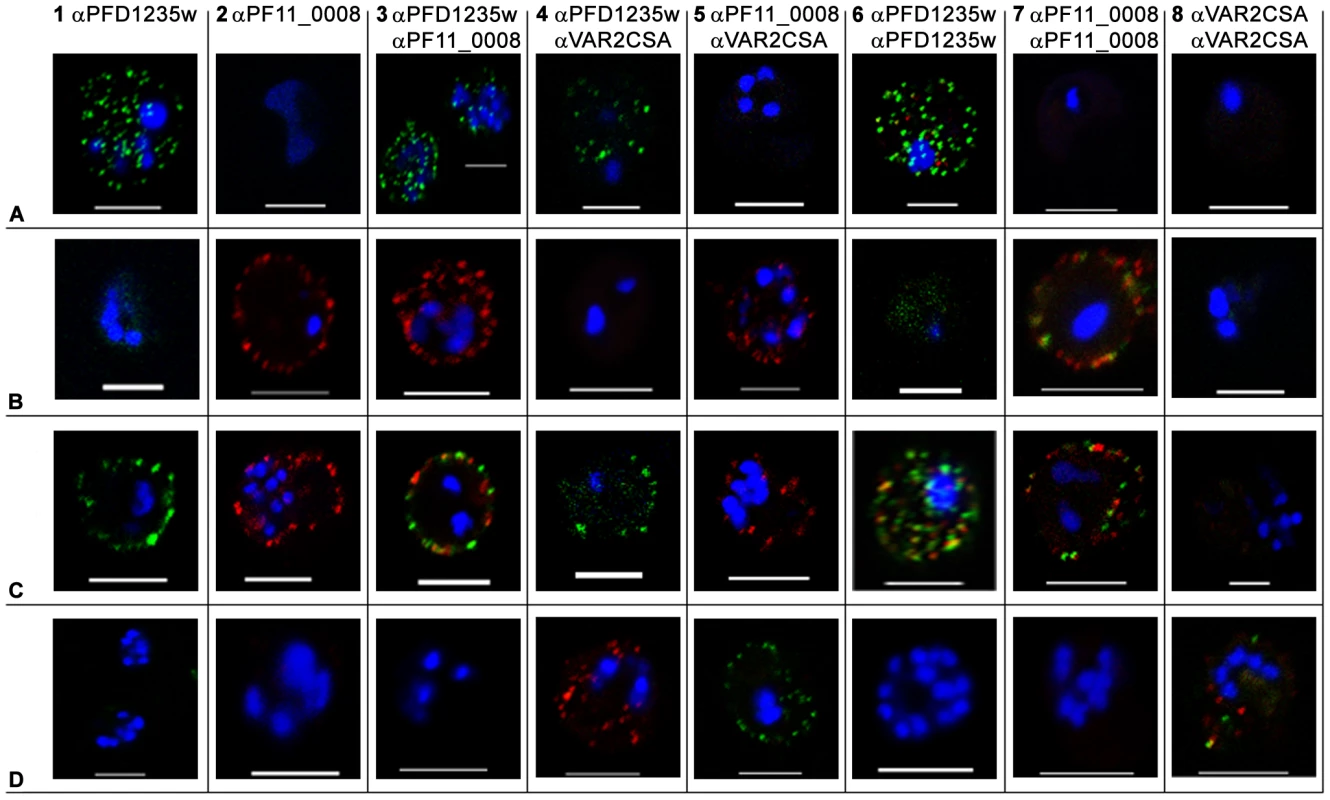 Surface expression of PfEMP1 on single 3D7 infected erythrocytes.