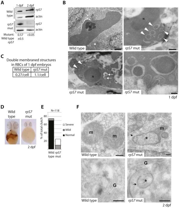 Reduction of rpS7 to haploinsufficient levels in zebrafish embryos induces autophagy in RBCs.