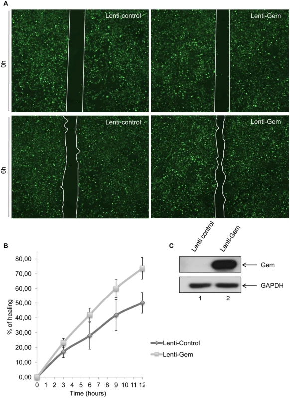 Gem expression is sufficient to increase cell motility.
