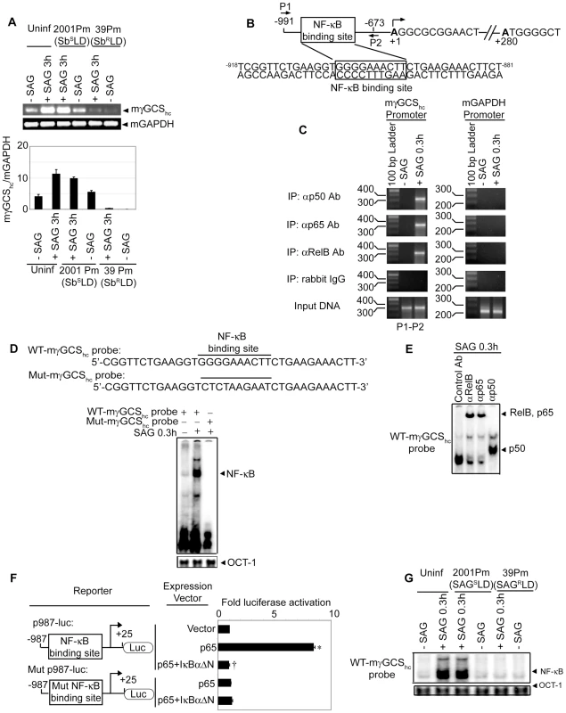 Suppression of SAG-induced mγGCS<sub>hc</sub> expression by Sb<sup>R</sup>LD is NF-κB-dependent.