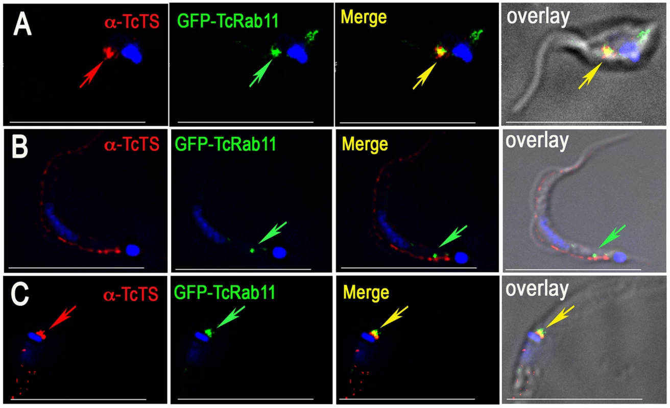 Localization of TcTS during differentiation to cell-derived and metacyclic trypomastigotes.