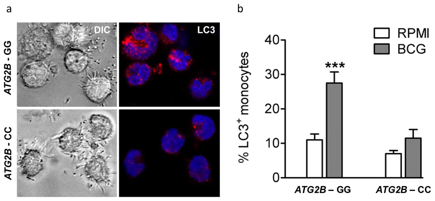 Autophagy affected by SNP in ATG2B.