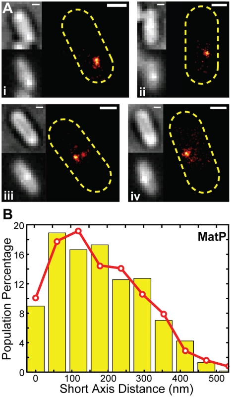 PALM imaging of MatP and <i>z</i>-position estimation.