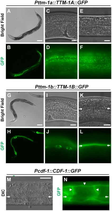 Intracellular localization of TTM-1 isoforms and CDF-1.