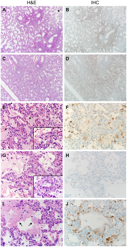 Histopathological changes in lungs of common marmosets inoculated with MERS-CoV.