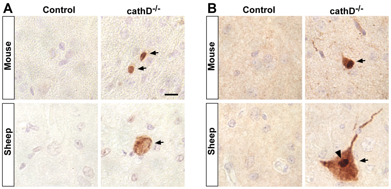 Caspase activation and truncation of tau in mammalian models of cathepsin D deficiency.