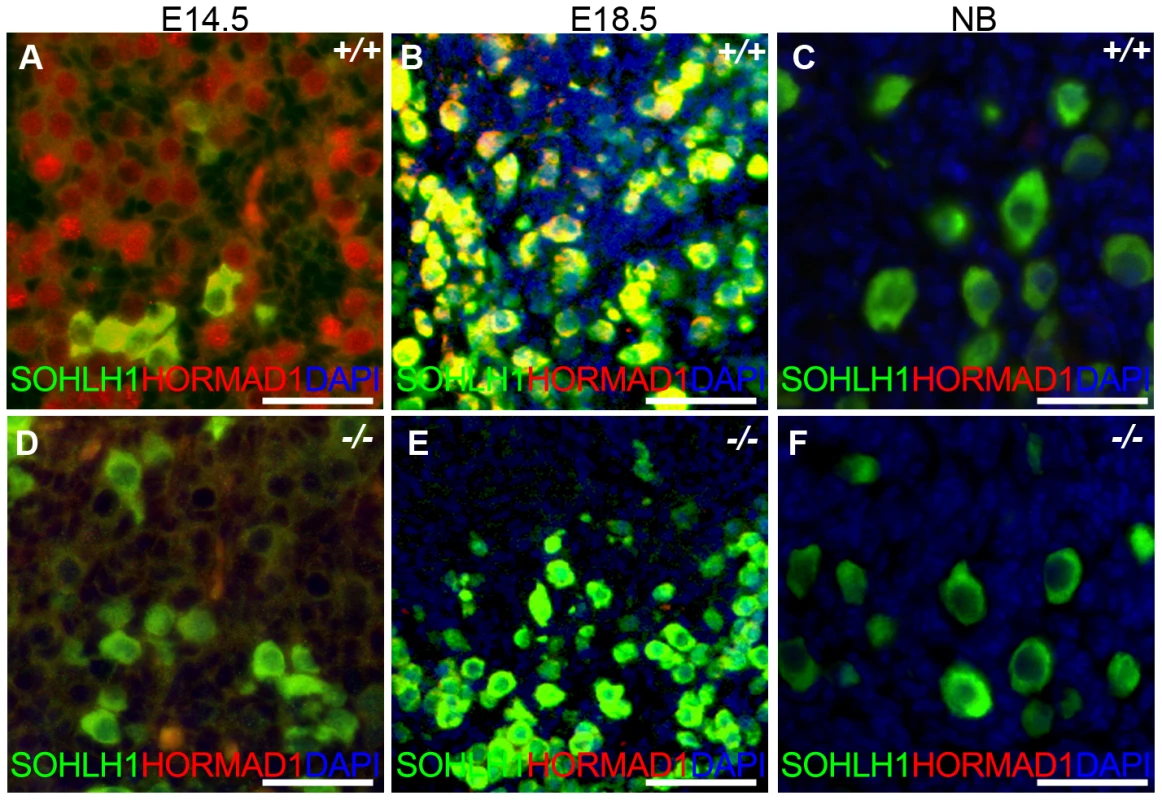 HORMAD1 is expressed in embryonic but not post-natal oocytes.