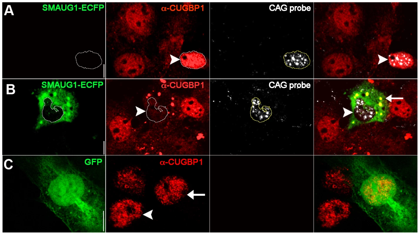 SMAUG1 expression reduces nuclear accumulation of CUGBP1, and both proteins co-localize in cytoplasmic granules.
