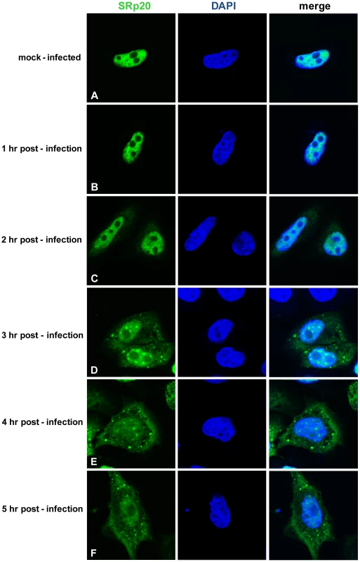 SRp20 re-localization from the nucleus to the cytoplasm of HeLa cells during poliovirus infection.