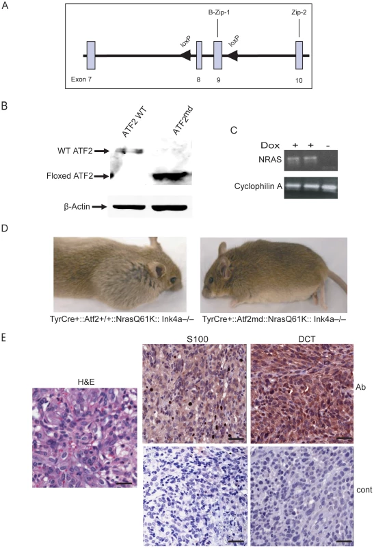 Melanoma development is inhibited in <i>Nras/Ink4a</i> mice expressing a melanocyte-specific ATF2 mutation.