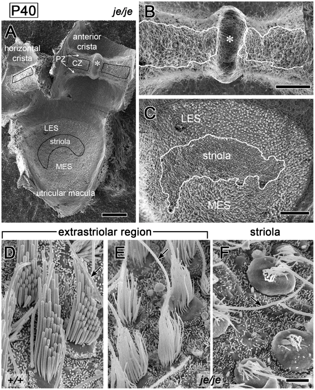 Regional differences in the fate of stereocilia on vestibular hair cells in <i>je/je</i> mice.